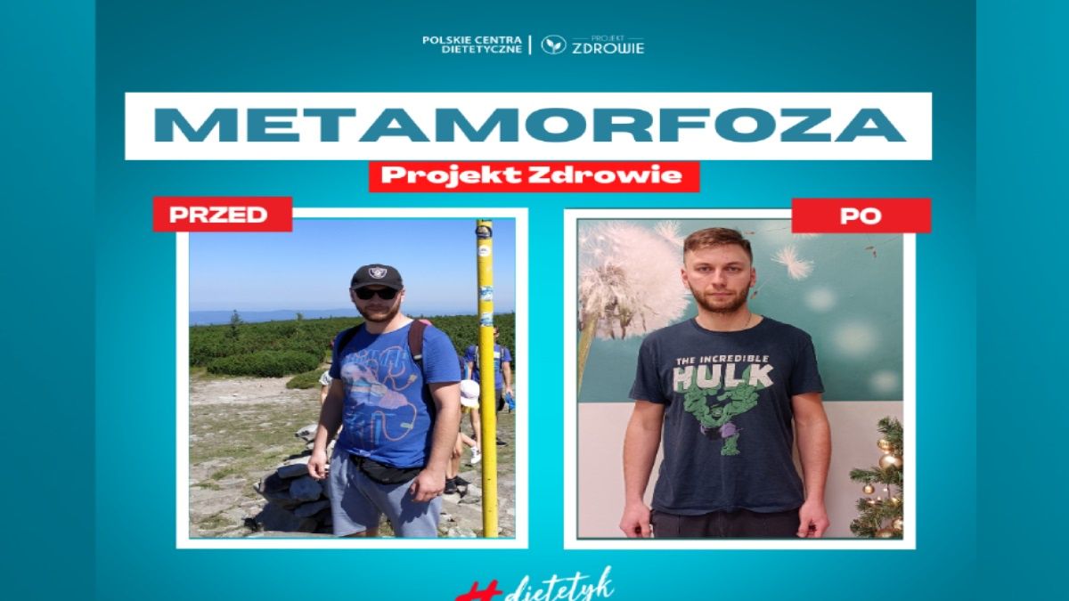 -15 kg u Szymona | Projekt Zdrowie