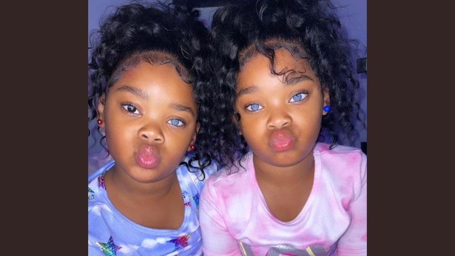 "Błękitnookie bliźniaczki" podbijają świat. Ludzie nie wierzą, że nie noszą soczewek