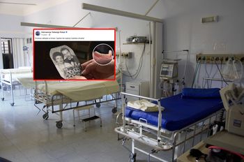 Proteza utknęła w krtani. 64-latka nie żyje. Dramat w szpitalu