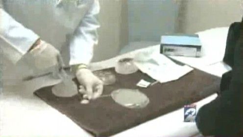 Nowa broń Al-Kaidy - wybuchowe implanty piersi (wideo) 1