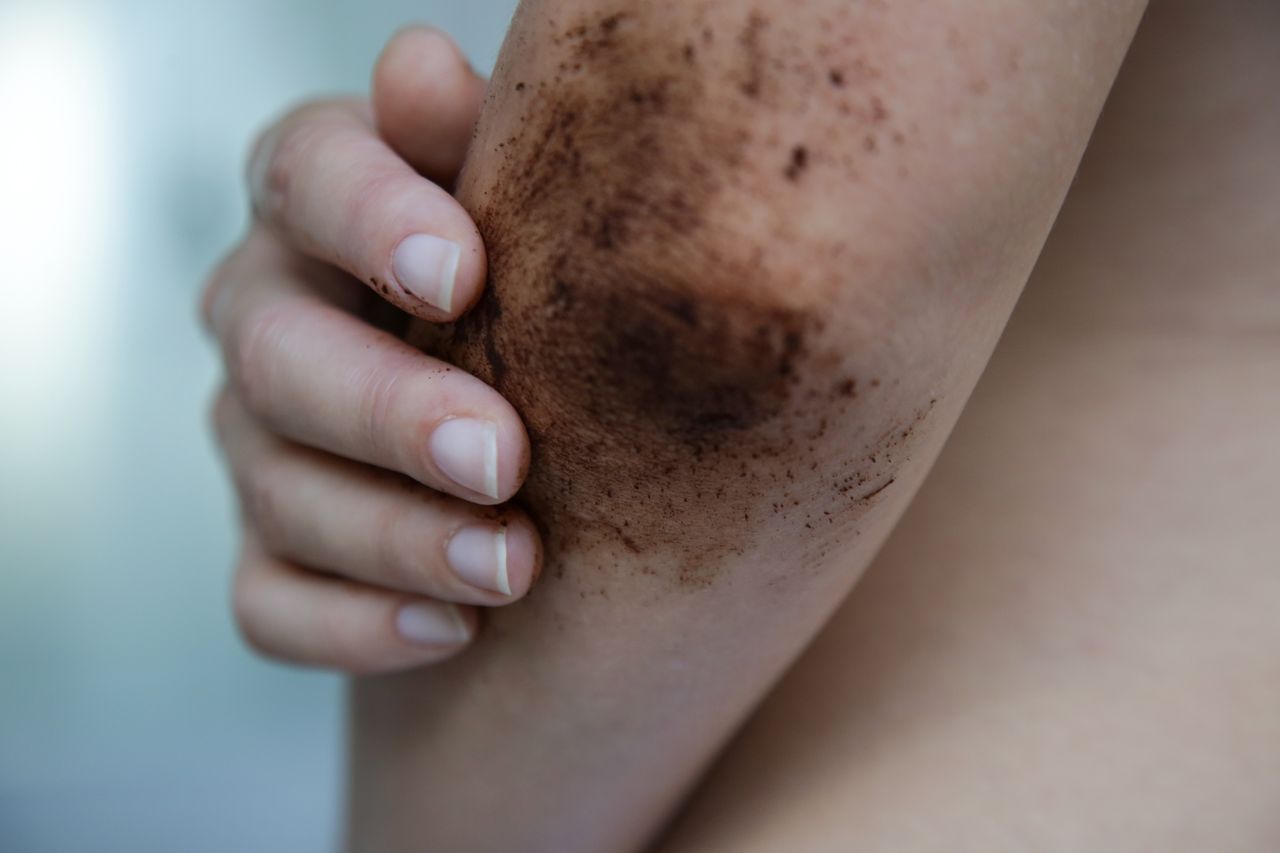 Peeling z kawy pomoże w walce z suchą skórą