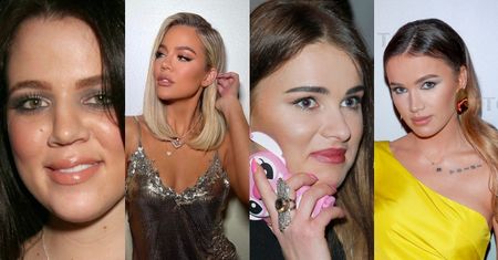 Gwiazdy, które zrobiły sobie NOS: Khloe Kardashian, Maffashion, Ewel0na i WIELE innych (ZDJĘCIA)