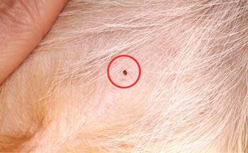 Groźniejsze nawet od kleszczy. Nie pomyl z pieprzykiem