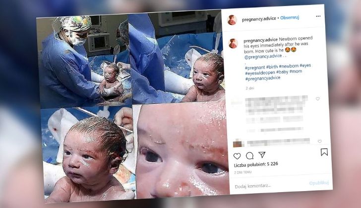 Noworodek otworzył oczy po porodzie. Niesamowite zdjęcie