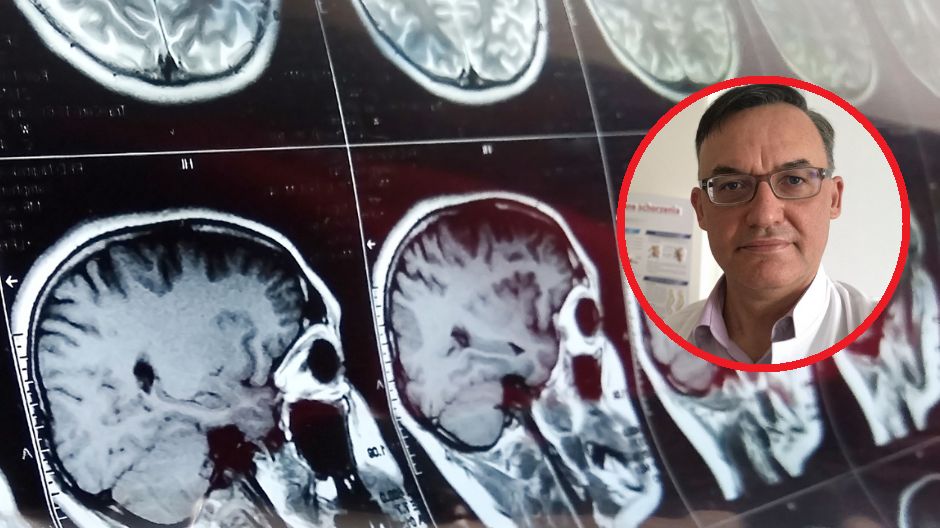 Udar to cichy zabójca