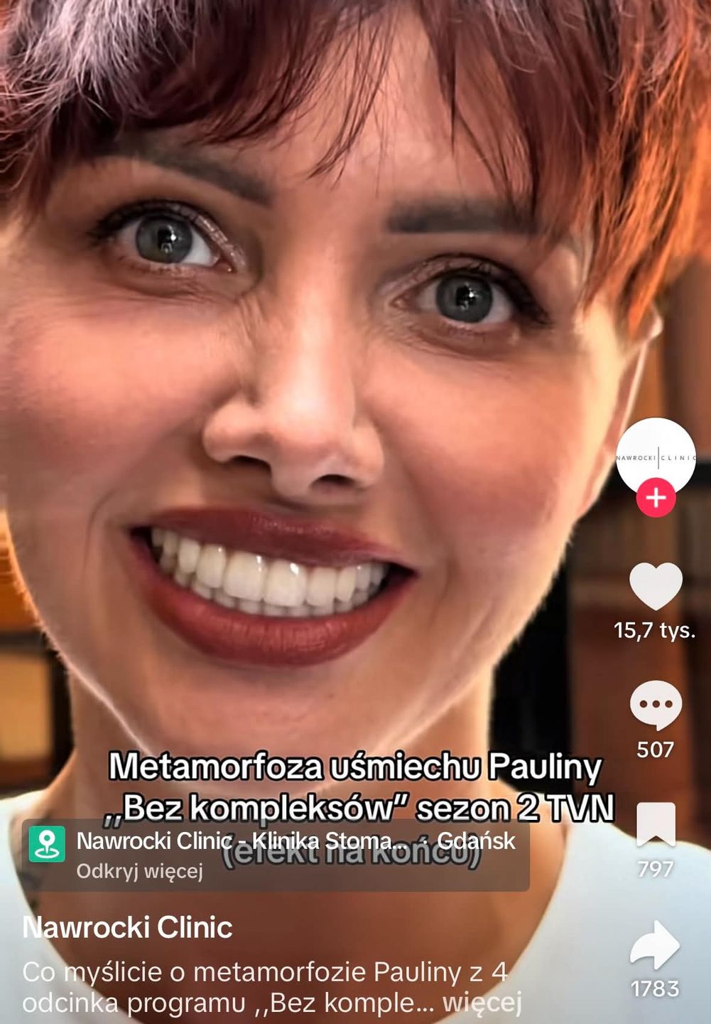 Metamorfoza zębów uczestniczki w programie "Bez kompleksów"