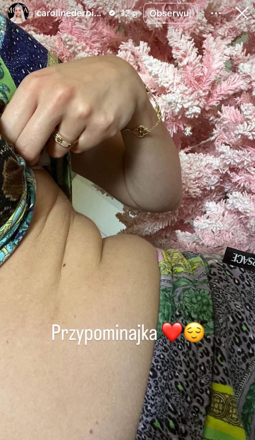 Caroline Derpienski pokazuje niedoskonałości