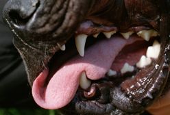 Australia. 5-latek zagryziony przez psa na oczach babci