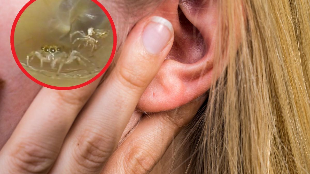 Kobieta skarżyła się na "szeleszczenie" w uchu. Lekarze znaleźli intruza w kanale słuchowym