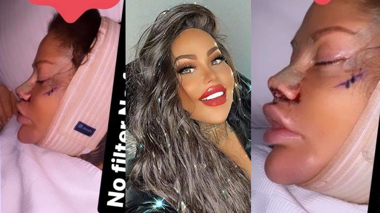 Laluna Unique chwali się odsysaniem tłuszczu w tureckiej klinice