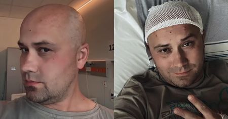 Adrian ze "Ślubu od pierwszego wejrzenia" przeszedł KOLEJNY ZABIEG. "Po usunięciu guza mózgu powstał krwiak"