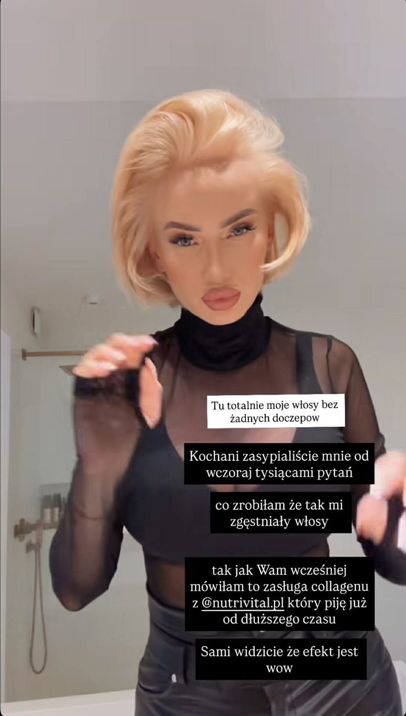 Izabela Macudzińska pokazała się bez doczepów