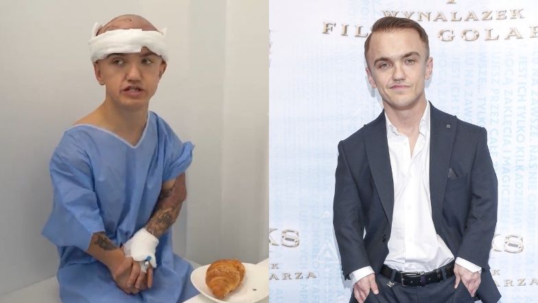Gwiazdy, które zdecydowały się na przeszczep włosów