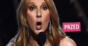 Będziecie w szoku. Céline Dion zafundowała sobie luksusową metamorfozę! W nowym wydaniu jest nie do poznania!