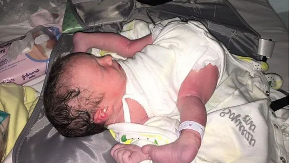 Urodziła się w niecodziennej pozycji. Lekarze nie mogli uwierzyć