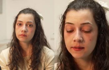 25-letnia Noelia dziś umrze. Podjęto decyzję o eutanazji. "Chcę przestać cierpieć i tyle"