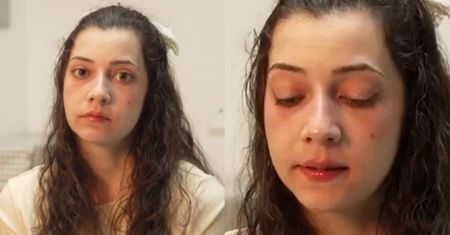 25-letnia Noelia dziś umrze. Podjęto decyzję o eutanazji. "Chcę przestać cierpieć i tyle"