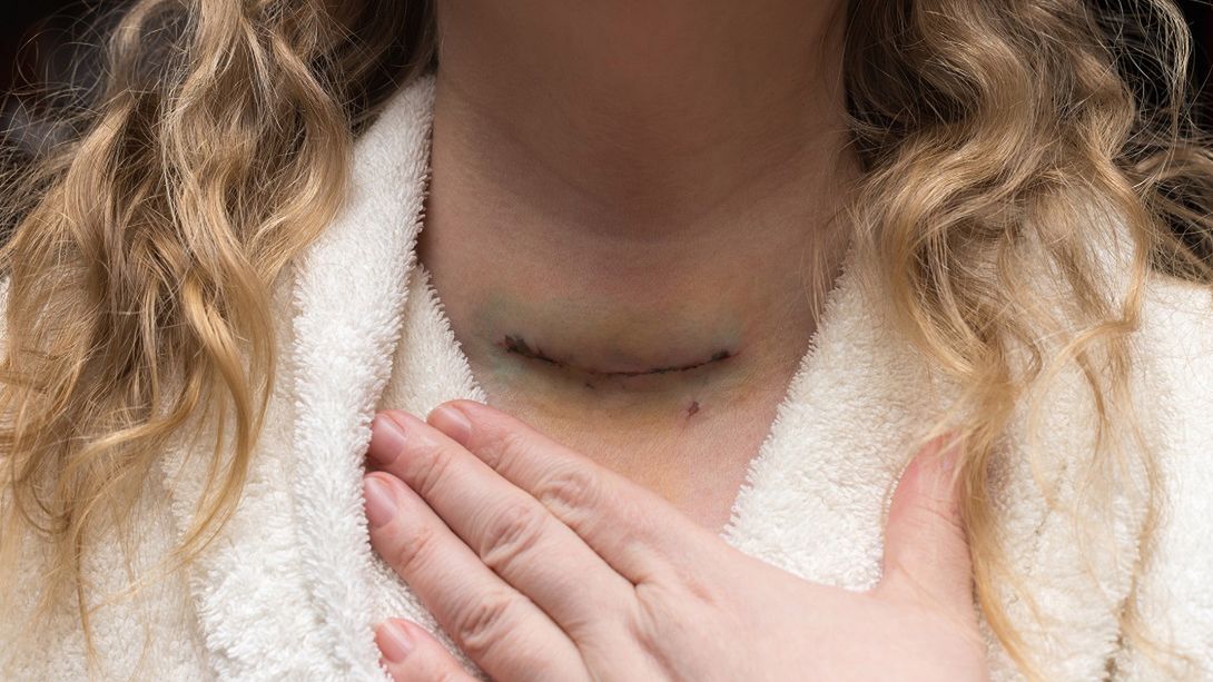 Jak alkohol wpływa na tarczycę?