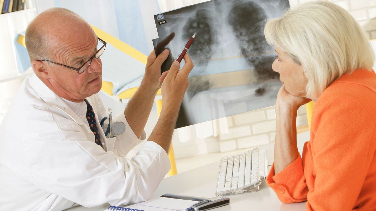 Rak płuc jest najbardziej złośliwym nowotworem na świecie.