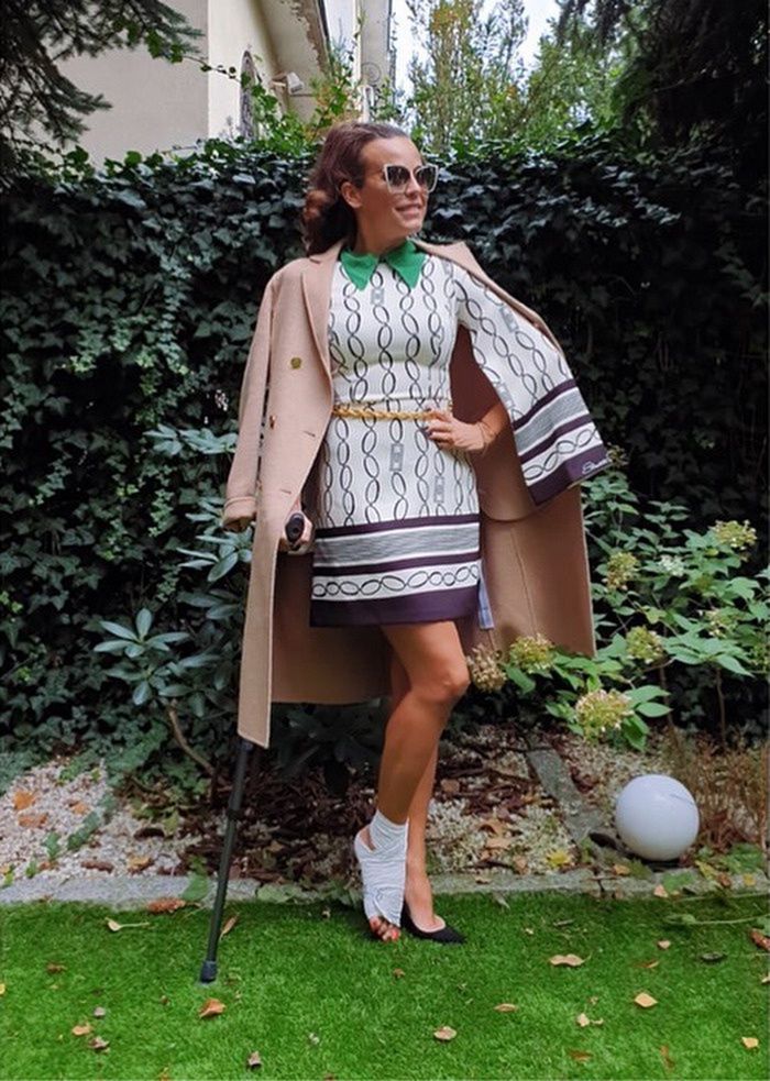 Anna Mucha zadaje szyku z opatrunkiem na nodze