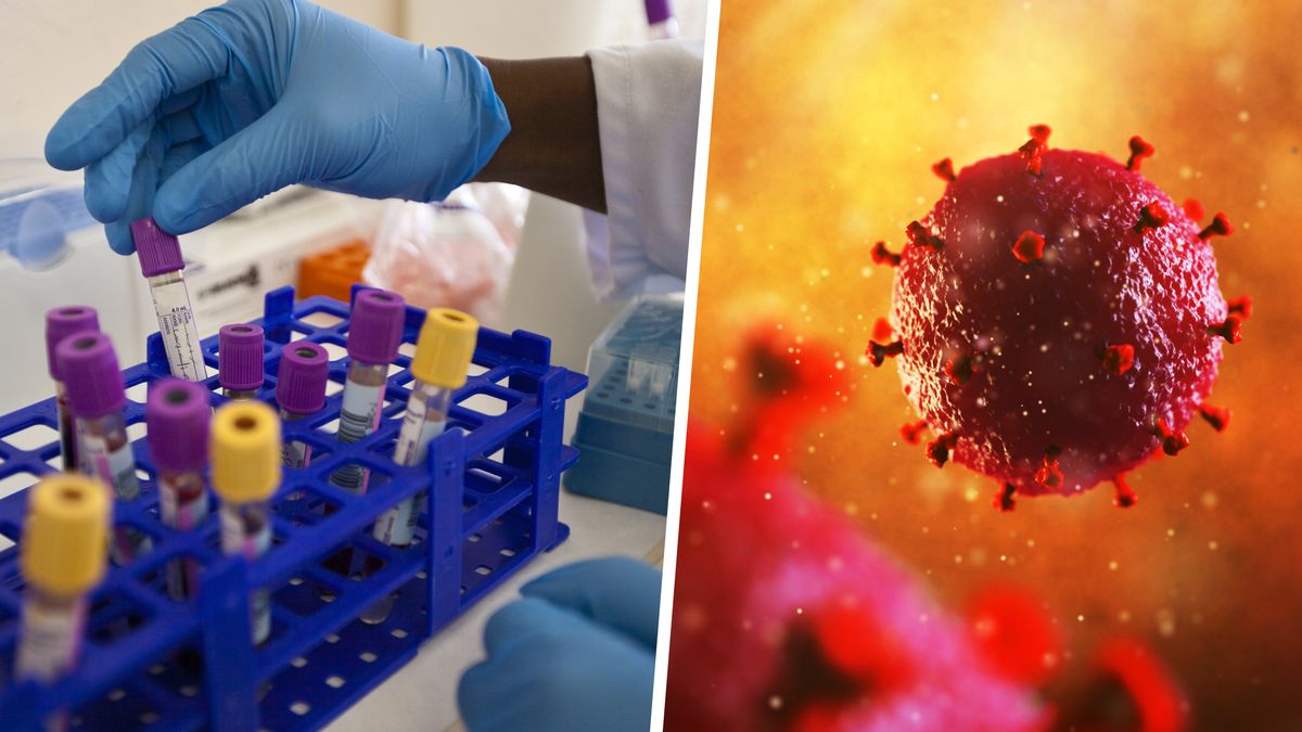 na zdjęciu wirus HIV i lekarze z fiolkami