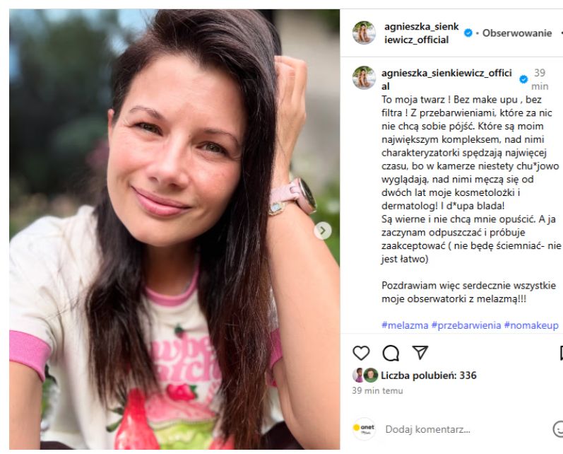 Agnieszka Sienkiewicz