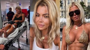 Grace Kubicka wspomina lato w skąpym BIKINI i przekazuje wieści o KONTUZJI: "Czasami wystarczy jedna sekunda" (FOTO)