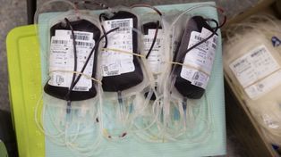 Pilny apel o oddawanie krwi. Jej pobieranie trwa kilka minut, a możesz uratować komuś życie