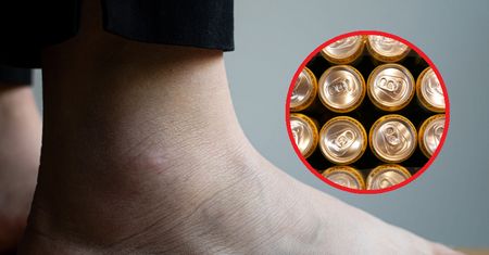 Zdewastowana alkoholem wątroba wysyła wyraźny sygnał. Nie ignoruj