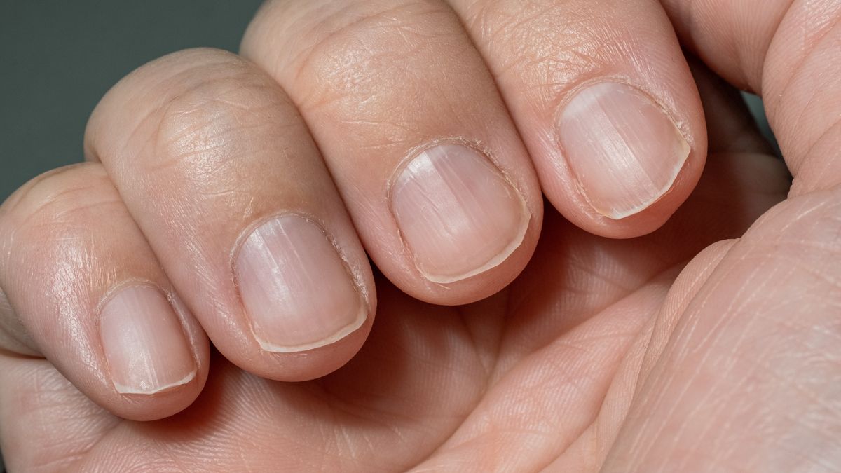 Plamki na paznokciach mogą oznaczać problemy ze zdrowiem