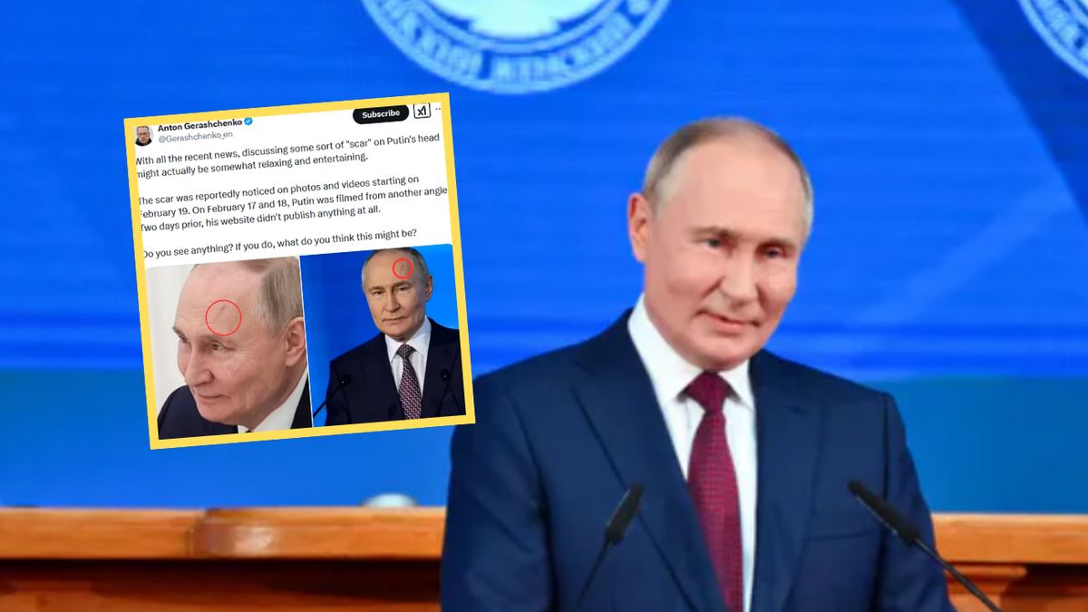 Dziwna blizna pojawiła się na czole prezydenta Rosji  