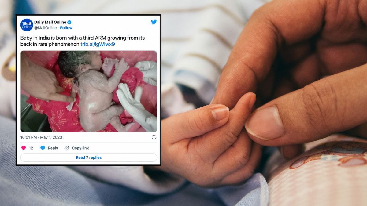 Zdjęcie ilustracyjne 