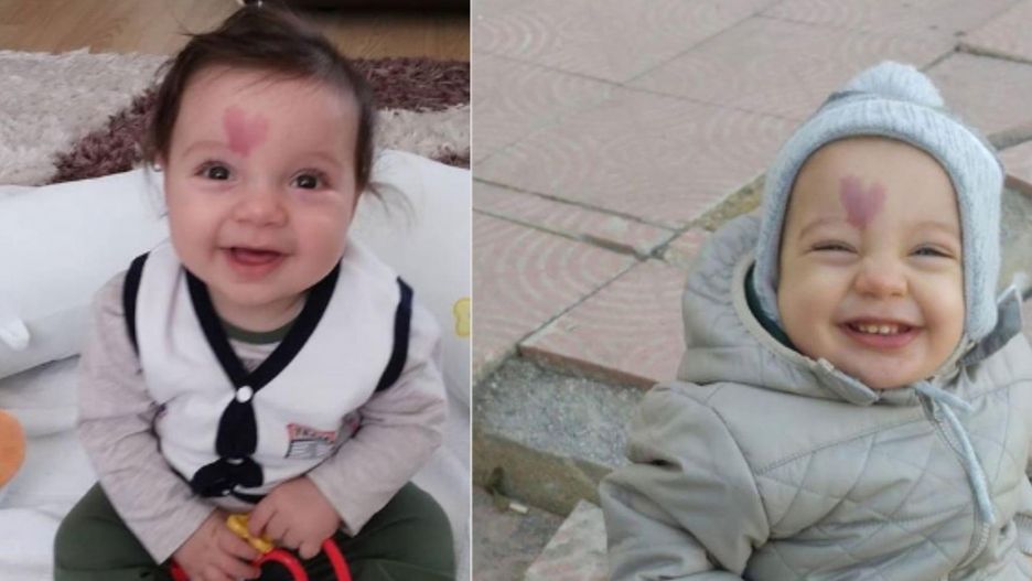 Chłopiec ze znamieniem w ksztalcie serca jest dziś rozpoznawalny na całym świecie