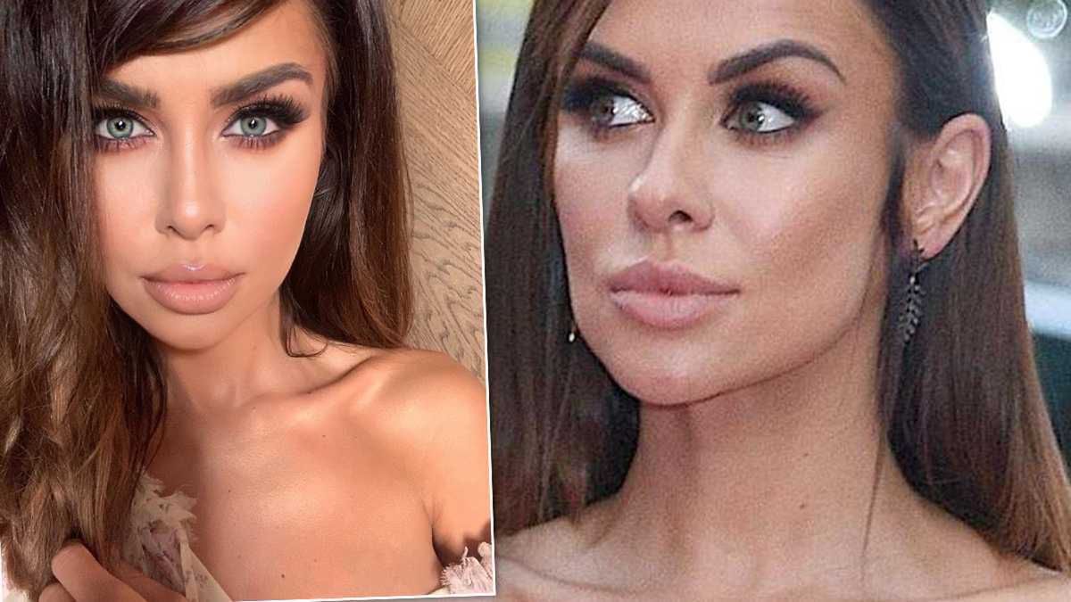 Natalia Siwiec - czy miała operacje plastyczną?