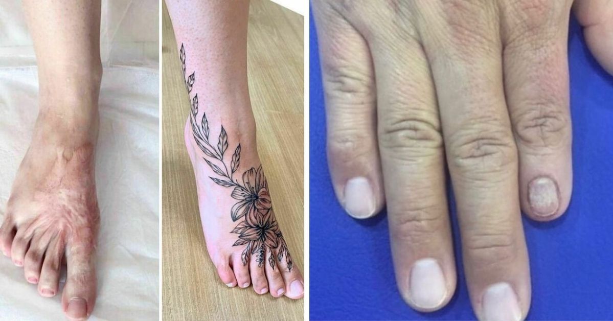 25 tatuaży do zadań specjalnych, które z łatwością zamaskują każde znamię oraz bliznę