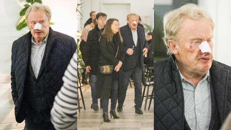 Daniel Olbrychski miał WYPADEK. Trafił do szpitala (ZDJĘCIA)