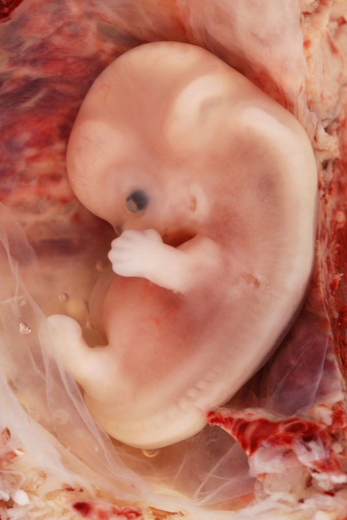 7-8 tygodniowy ludzki zarodek