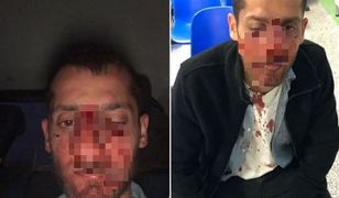 Pobicie Żydów w Warszawie. Prokuratura wszczyna śledztwo