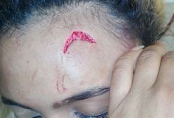 Żona prezydenta Zimbabwe oskarżona o pobicie modelki. Przedłużaczem