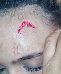 Żona prezydenta Zimbabwe oskarżona o pobicie modelki. Przedłużaczem