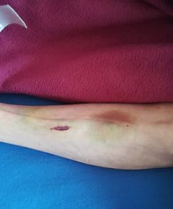 79-letnia kobieta miała zostać pobita przez opiekunkę. "Zrobiła z mojej mamy kalekę"