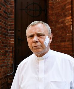 Atak na księdza w Szczecinie. Nadzór Prokuratury Krajowej nad sprawą