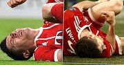 MOCNE! Robert Lewandowski pokazał zmasakrowaną twarz! Tak urządzili go "koledzy" z boiska