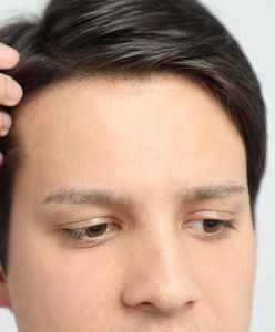 Transplantacja włosów - sposób na podniesienie męskiej atrakcyjności
