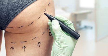Hakerzy ukradli zdjęcia z kliniki plastycznej dla celebrytów. "Mamy zdjęcia członków rodziny królewskiej"