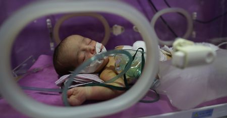 Uratowali noworodka transmitując operację komórką. Chirurg słuchał podpowiedzi