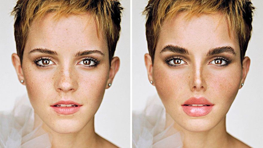 Tak wyglądałaby Emma Watson po najpopularniejszej operacji plastycznej
