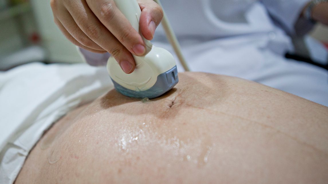 dziecko ciąża lekarz aborcja