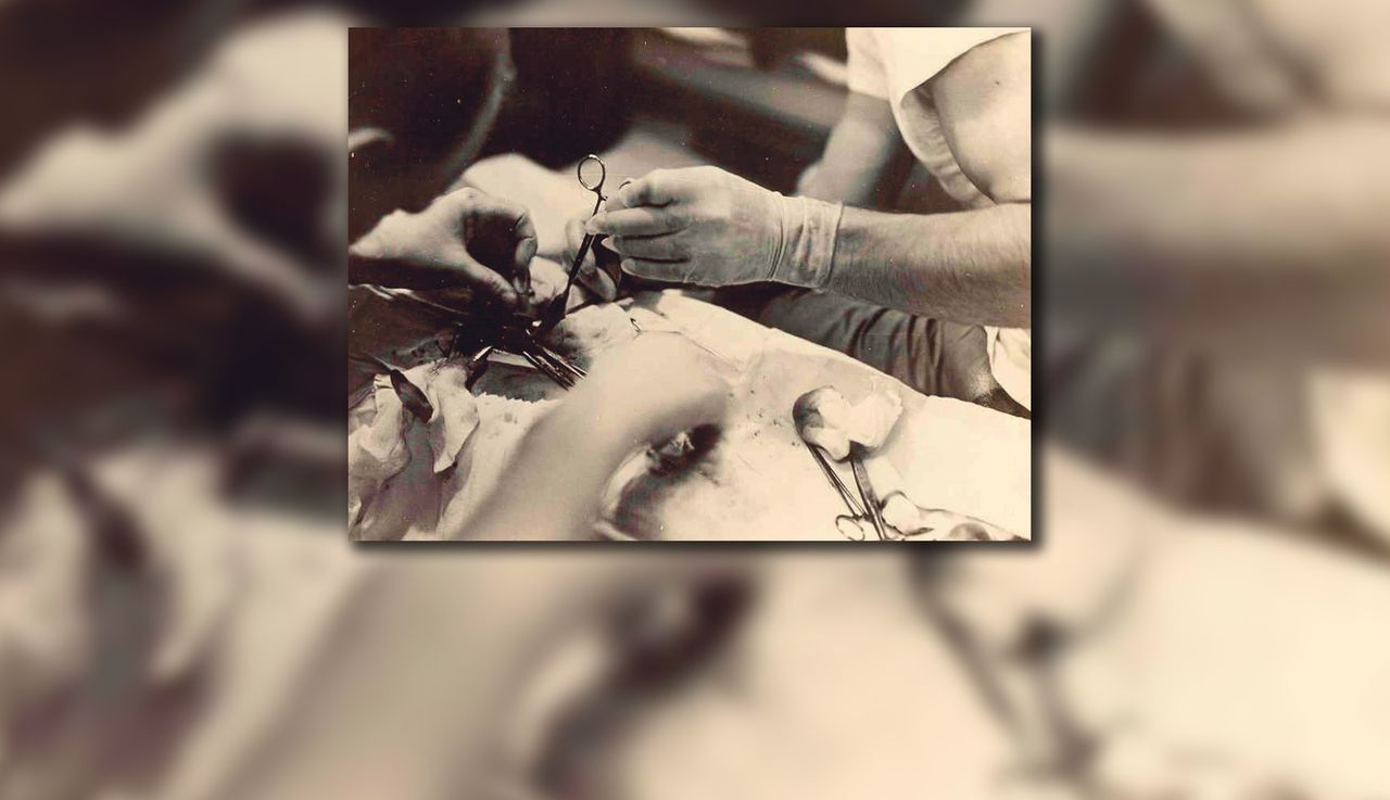 Operowali za pomocą łyżki i sita. Pod wodą nie było innego wyjścia