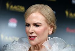 Nicole Kidman próbuje zatrzymać czas. Lekarz wylicza, co poprawiła w twarzy